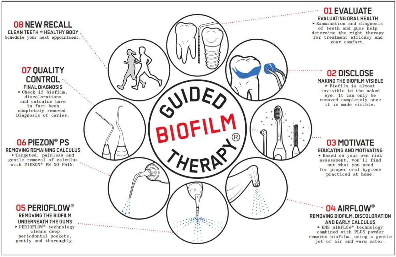 Airflow Polish West Dulwich Dental Airflow Teeth Clean In Dulwich